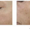 SkinBetter Science Trio Rebalancing Moisture Treatment - Image 4